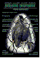 (3kB)